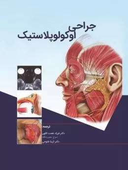  کتاب الکترونیک جراحی اوکولوپلاستیک